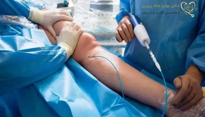 آنژیوگرافی