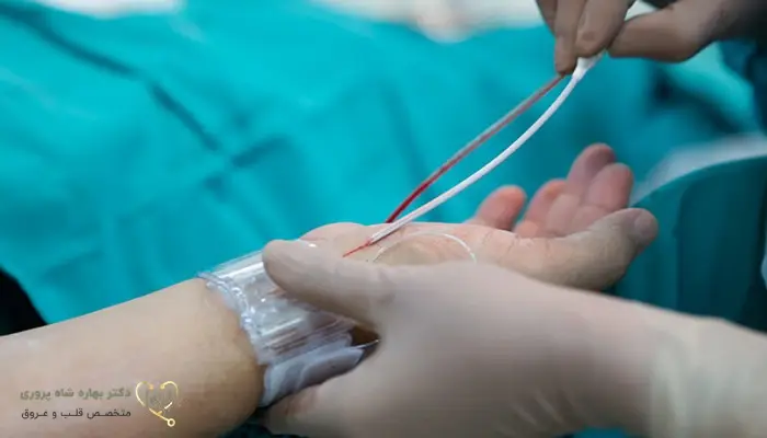آنژیوگرافی
